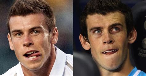 gareth bale ears